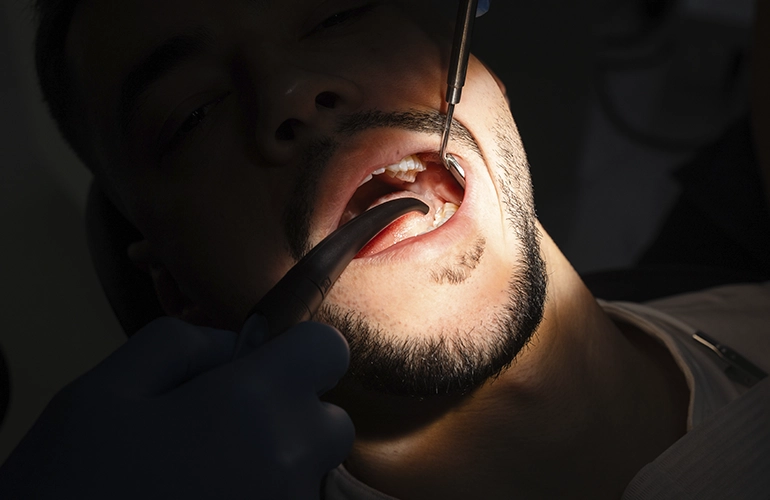 Extração de dente do siso